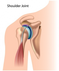 shoulder-arthroscopy